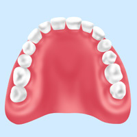 保険適用の入れ歯（レジン床義歯）